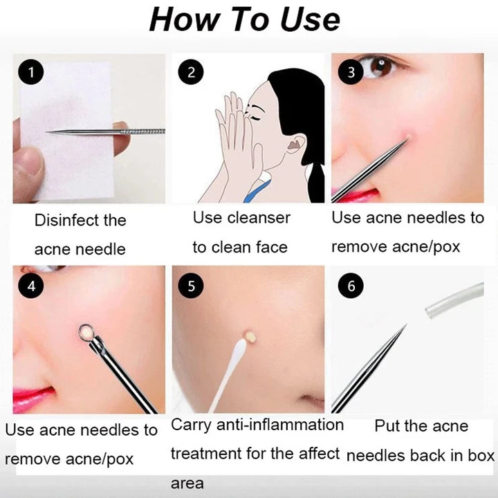 4-in-1 Multifunctional Blackhead Vacuum