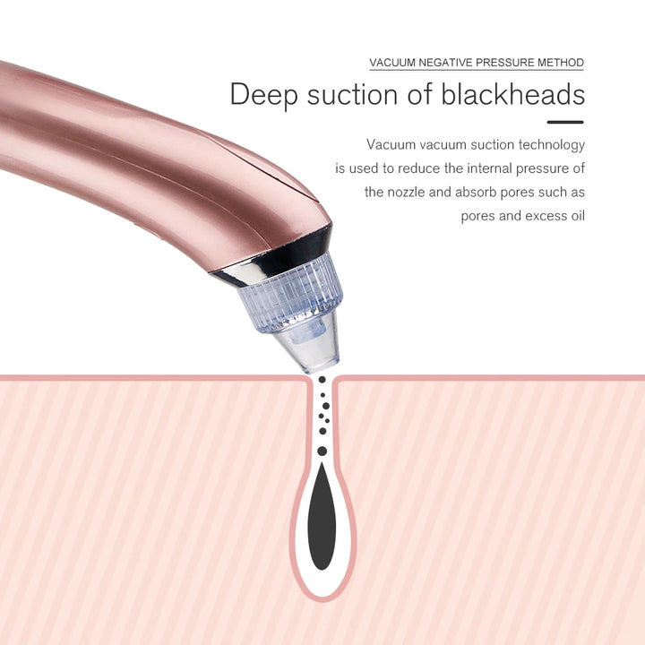 4-in-1 Multifunctional Blackhead Vacuum