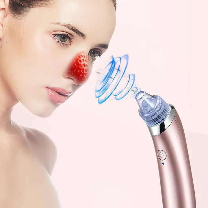 4-in-1 Multifunctional Blackhead Vacuum