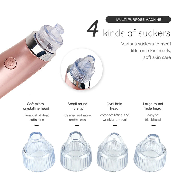 4-in-1 Multifunctional Blackhead Vacuum