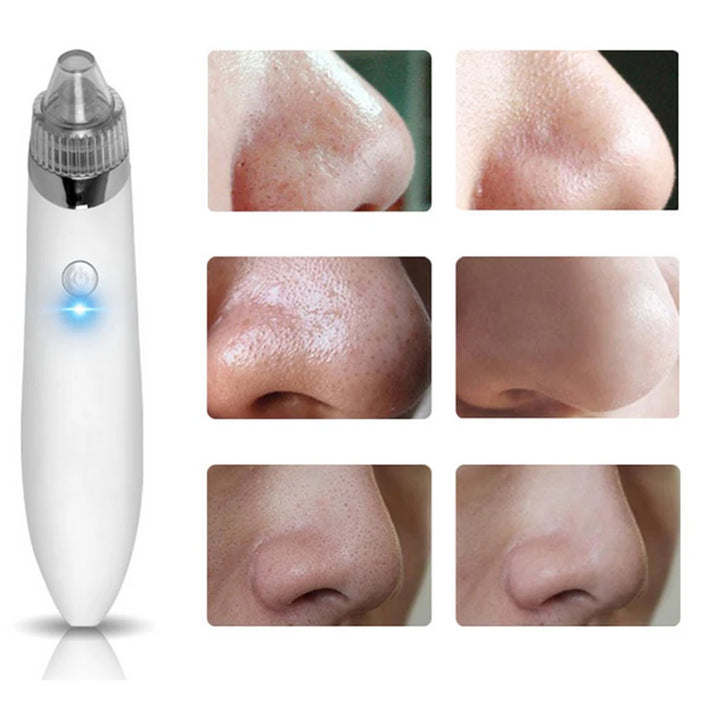 4-in-1 Multifunctional Blackhead Vacuum